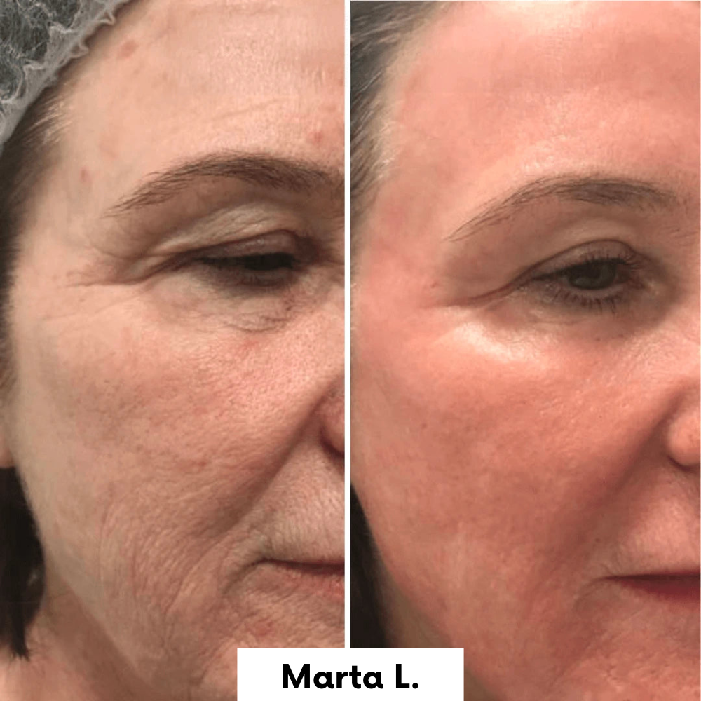 Máscara Nocturna Restauradora con Colágeno | Hidrata, regenera y rejuvenece mientras dormís