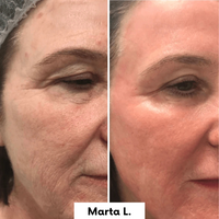 Máscara Nocturna Restauradora con Colágeno | Hidrata, regenera y rejuvenece mientras dormís